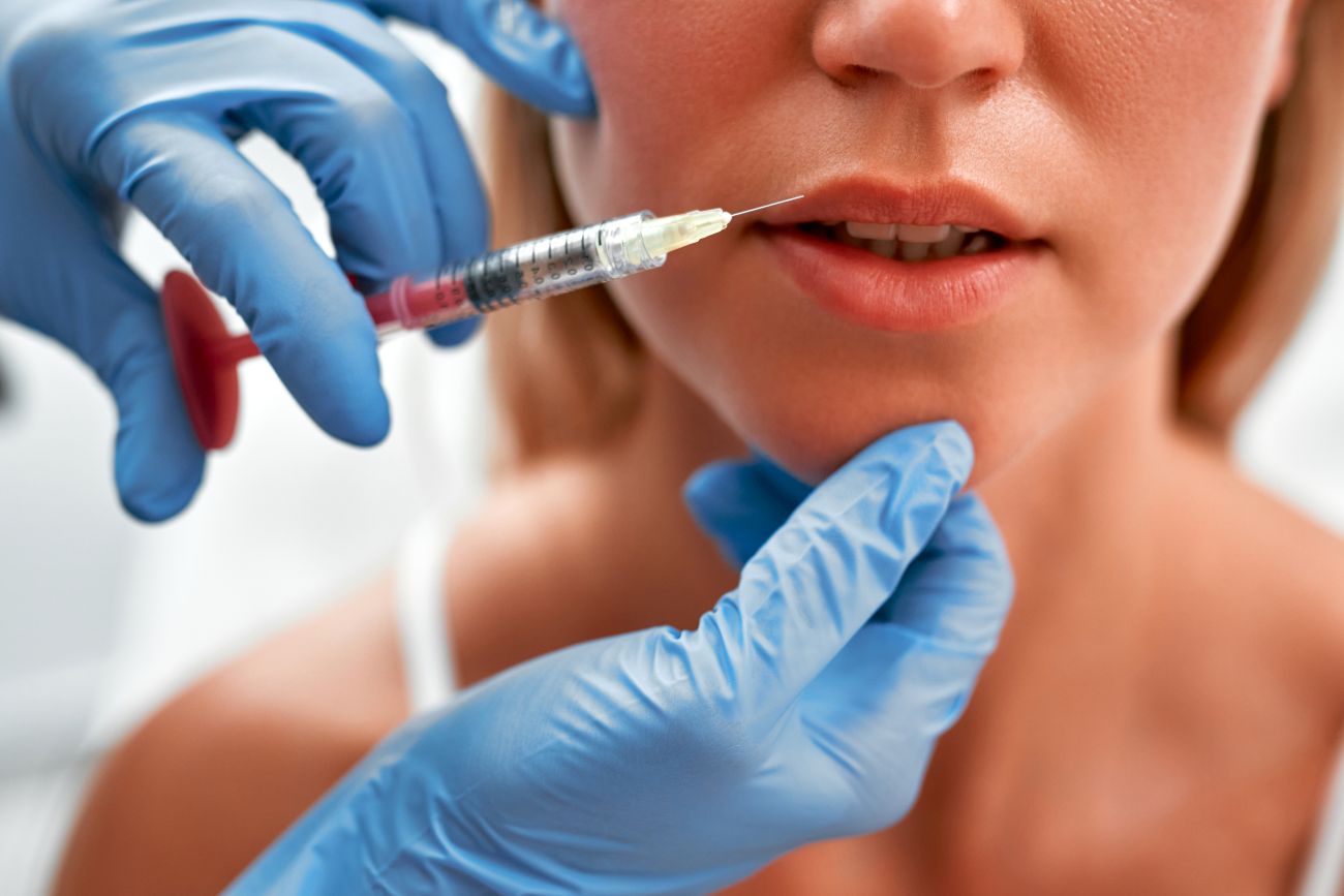 Kwas hialuronowy w akcji czyli o zabiegu powiekszania ust